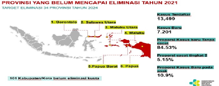 Perspektif Hukum dan Sosiologis terhadap Penanggulangan Kusta di Indonesia