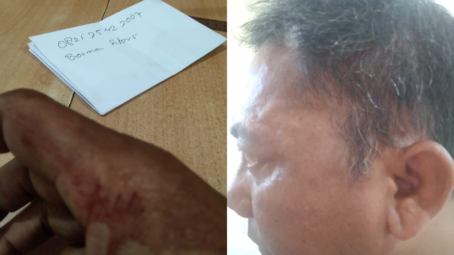 Kembali Terjadi Penganiayaan Terhadap Jurnalis, Wartawan Minta APH Proses dengan Seadil-adilnya